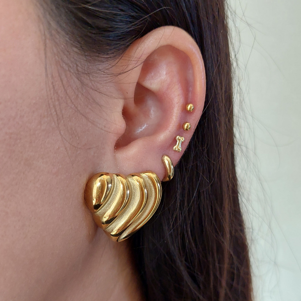 Arete Venecia