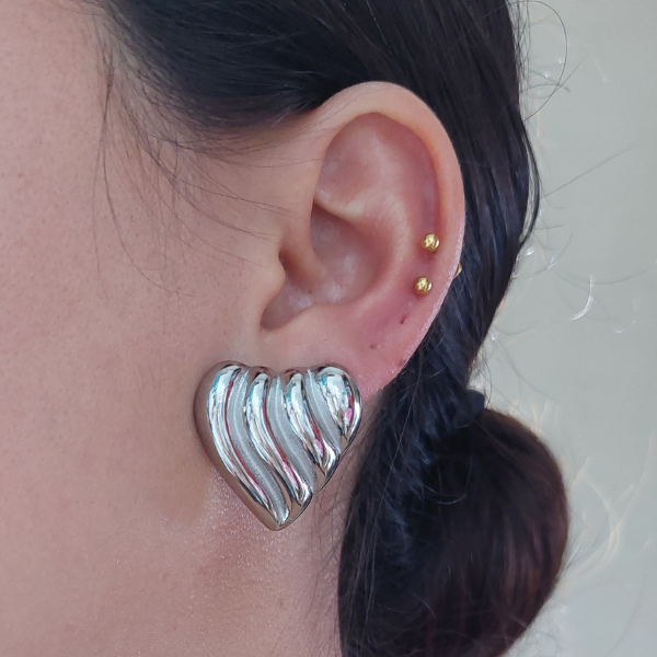 Arete Venecia
